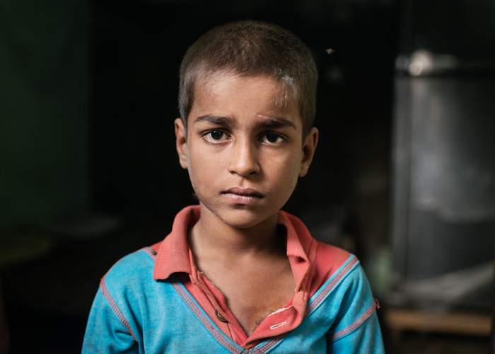 Abu is one of many children who work in unregulated factories